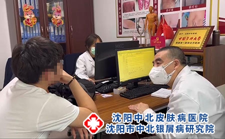 沈陽哪里有銀屑病-沈陽哪家能治銀屑病