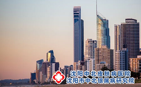 選擇沈陽中北銀屑病研究院治療怎么樣?