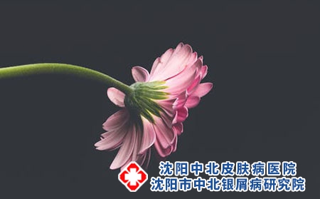 1 (1042)