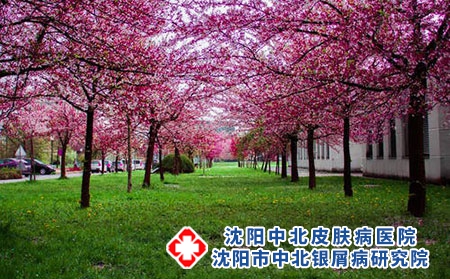 沈陽治療銀屑病權威的醫院有哪些?