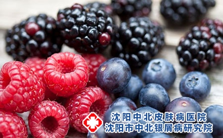 牛皮癬患者夏季可以喝冷飲嗎?如何科學飲食?
