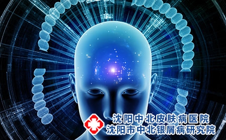 牛皮癬如何減少復(fù)發(fā)_沈陽康平銀屑病的醫(yī)院哪個好
