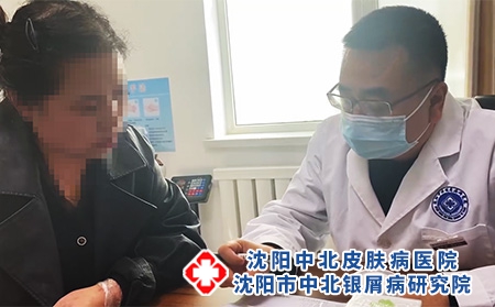沈陽治療銀屑病要到醫院檢查啥?【沈陽中北皮膚病醫院治療皮膚病】