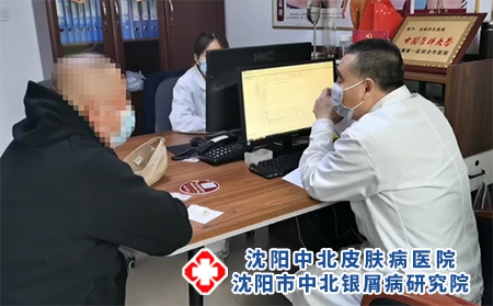 [好榜單]沈陽銀屑病在哪個醫院[排名前五]沈陽銀屑病醫院哪的好[口碑醫院]