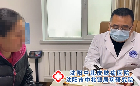 沈陽(yáng)看銀屑病哪好-沈陽(yáng)哪有治療銀屑病