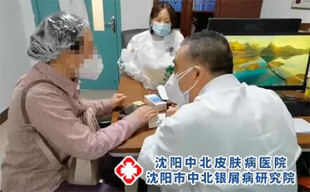 沈陽牛皮癬的治療-沈陽銀屑病哪治得好