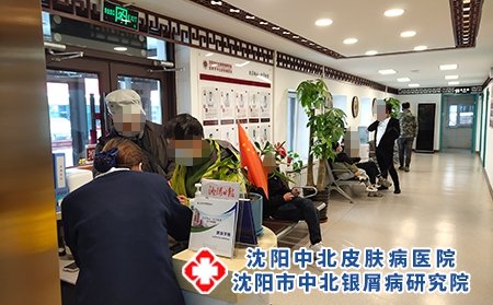 沈陽專業看銀屑病-沈陽治療銀屑病的藥