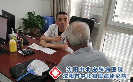沈陽銀屑病到哪治-沈陽治銀屑病的哪好