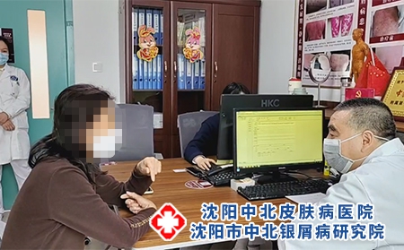 沈陽治銀屑病醫院-沈陽銀屑病哪里專治