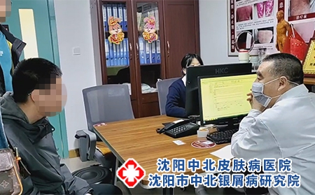 沈陽哪看銀屑病好-沈陽哪里能治銀屑病