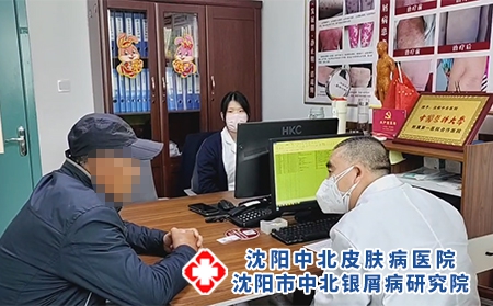 沈陽看銀屑病專科-沈陽哪能治療銀屑病
