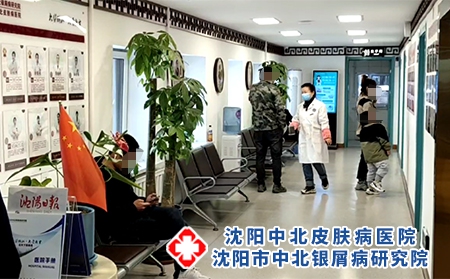 沈陽中醫銀屑病看-沈陽哪個醫院看的好