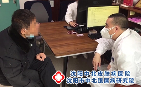 沈陽中醫(yī)院銀屑病-沈陽牛皮癬去哪治療