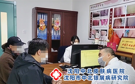 沈陽好的銀屑病治-沈陽哪治銀屑病較好