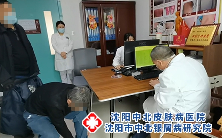 沈陽醫院銀屑病好-沈陽主治銀屑病醫院