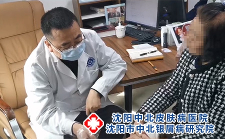 沈陽看銀屑病好的-沈陽哪有專治銀屑病