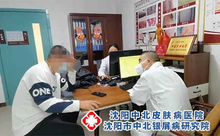 沈陽醫院看銀屑病-沈陽專治銀屑病醫院