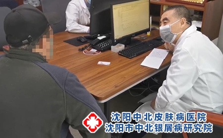 沈陽銀屑病醫院好-沈陽牛皮癬皮膚醫院