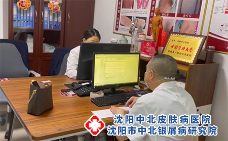 沈陽牛皮癬專科醫院如何選擇-沈陽有哪些出名的銀屑病醫院