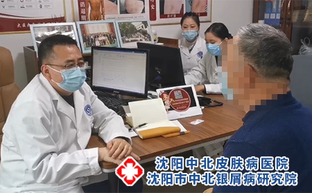 沈陽哪里治牛皮癬-沈陽去哪里治銀屑病