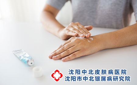 攝圖網_300119676_醫學,醫療保健人的密切婦女的手應用奶油治療藥膏用奶油治療藥膏雙手（企業商用）