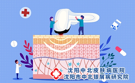 攝圖網(wǎng)_401916207_光子嫩膚醫(yī)美配圖（企業(yè)商用）