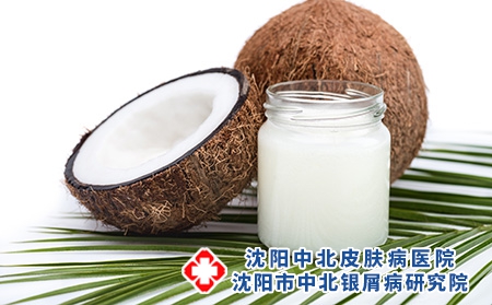 攝圖網_502749242_純熟椰子和有機椰子油（企業商用）