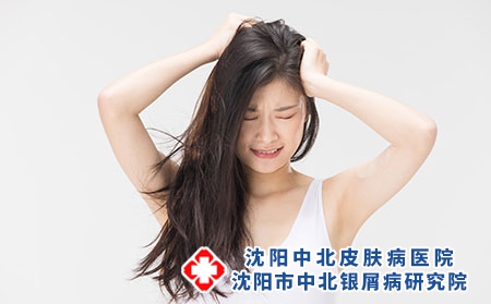 攝圖網_501713659_脫發問題抓頭苦惱的年輕女性（企業商用）