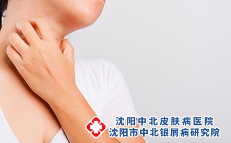 攝圖網_307247341_瘙癢皮膚（企業商用）