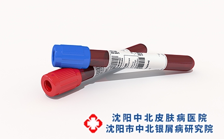 攝圖網(wǎng)_401722047_3D采血管（企業(yè)商用）