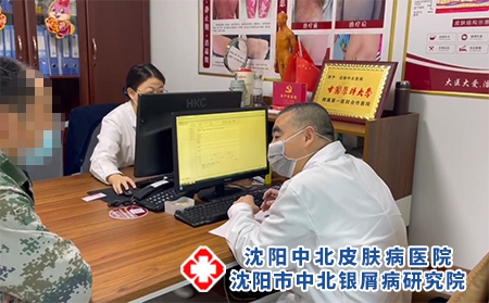 沈陽哪治療銀屑病-沈陽治療銀屑病哪好