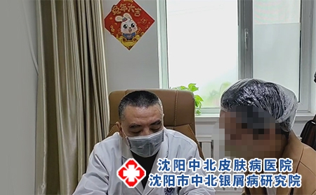 沈陽牛皮癬能治嗎-沈陽銀屑病到哪兒治