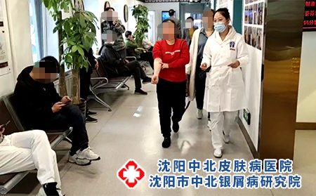 沈陽(yáng)牛皮癬咋治療-沈陽(yáng)哪能治好銀屑病