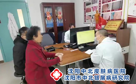 沈陽銀屑病好不好-沈陽醫(yī)院治療牛皮癬