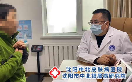沈陽銀屑病看哪好-沈陽牛皮癬醫治醫院