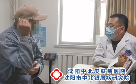 沈陽銀屑病哪里好-沈陽牛皮癬醫院百科