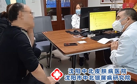 沈陽銀屑病皮膚科-沈陽牛皮癬去哪里治