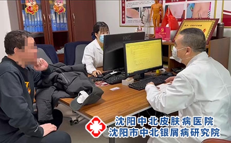 沈陽銀屑病有哪些-沈陽牛皮癬醫院位置