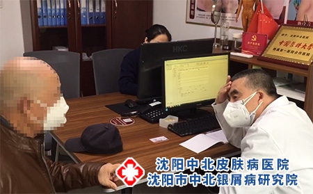 沈陽銀屑病怎么治-沈陽牛皮癬哪治療好