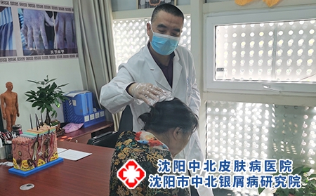 沈陽周邊的銀屑病-沈陽牛皮癬專家排名