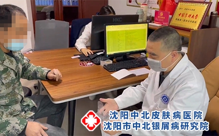 沈陽專治銀屑病院-沈陽去哪治療牛皮癬