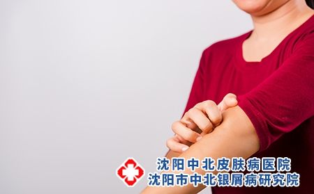 攝圖網_307247209_瘙癢皮膚（企業商用）
