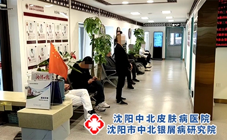 沈陽銀屑病哪里治-沈陽治牛皮癬哪兒好