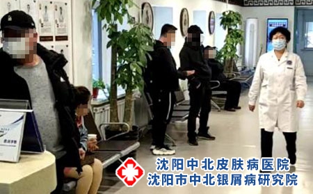 沈陽銀屑病怎么樣-沈陽牛皮癬醫院費用