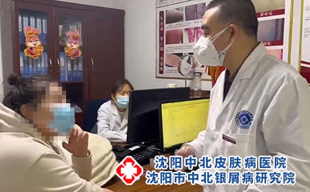 沈陽銀屑病專家號-沈陽牛皮癬哪家正規
