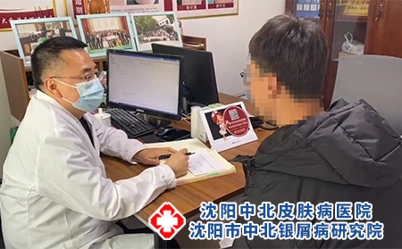 沈陽市中北銀屑病-沈陽銀屑病去哪兒治