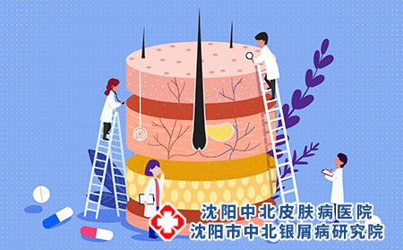 攝圖網_401915919_皮膚分層人體皮膚結構扁平插畫（企業商用）