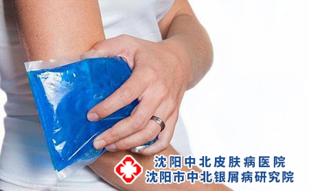 2 (63)關(guān)節(jié)