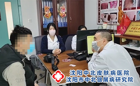 沈陽哪個銀屑病好-沈陽哪里醫治銀屑病