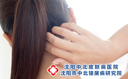 3 (153)頭